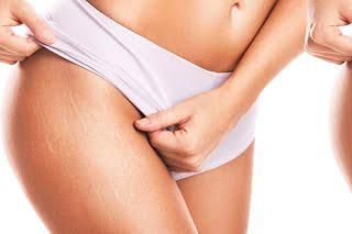 SOIN ZONE INTIME + EPILATION image