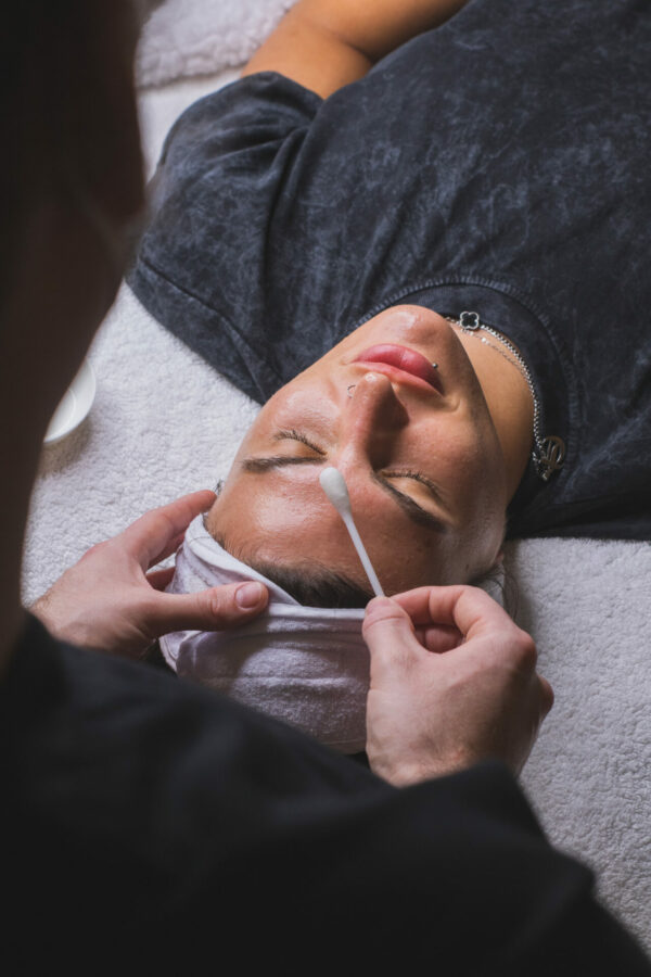 PRE-TRAITEMENT RESURFACING + 1ER PEELING image