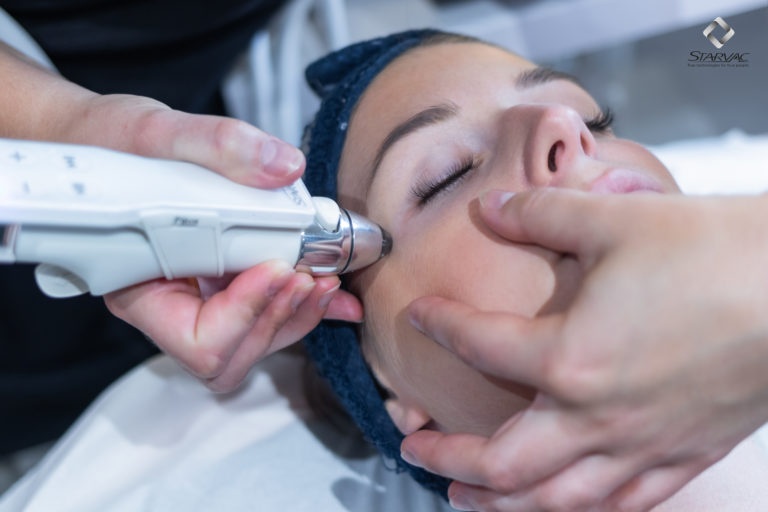 Option Soin magie du regard image