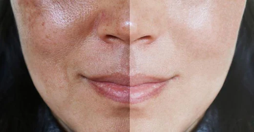 Soin Correcteur des taches pigmentaires Christina cosmétics image