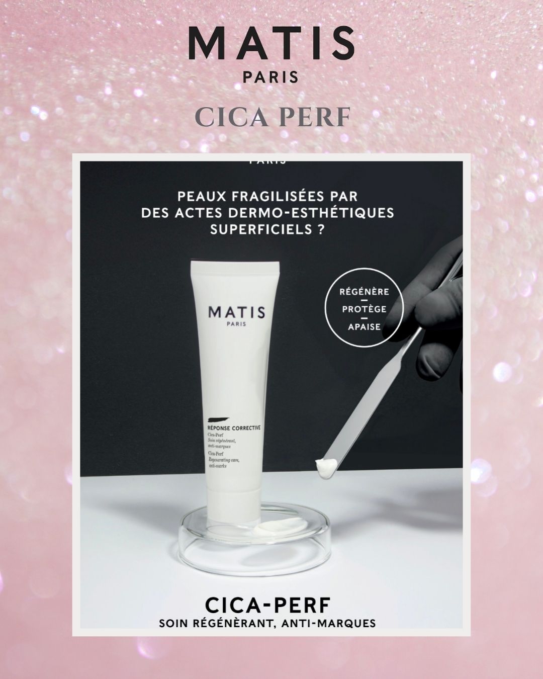 CICA PERF image