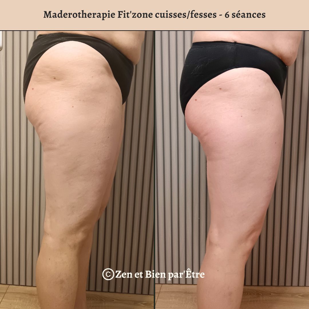 Cure Minceur Bien-être - Maderothérapie Fit'Zone - 6 Séances image