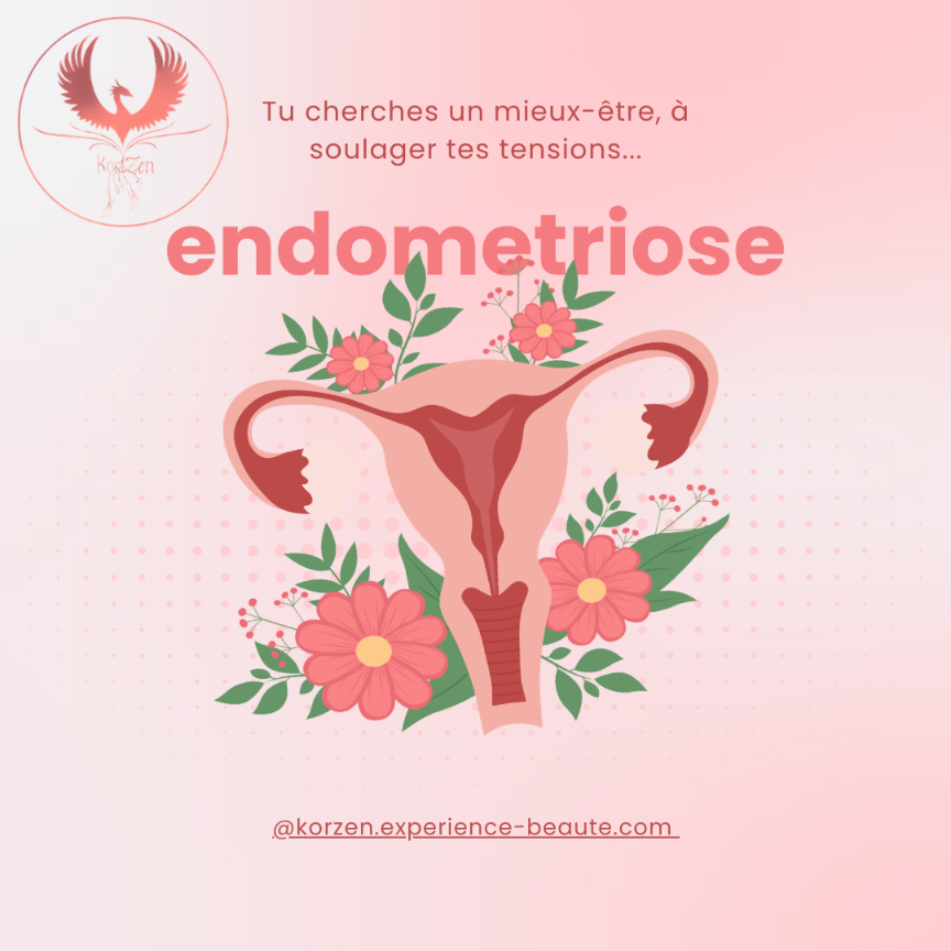 Rituel endométriose image